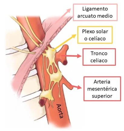 imagen aorta